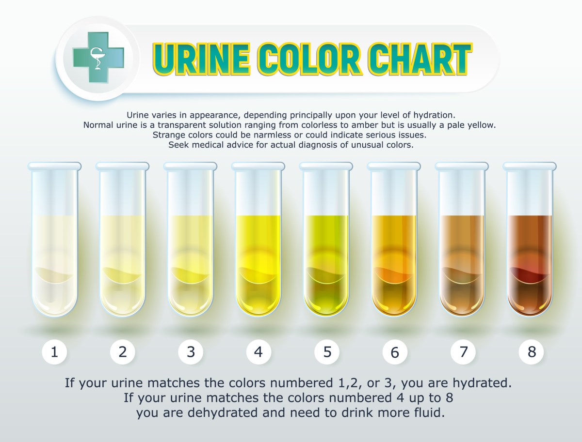 cloudy urine